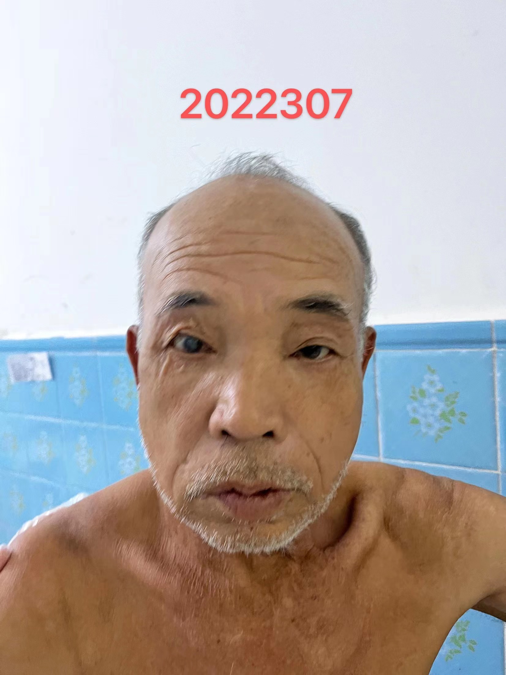 走失者照片 南宁寻亲：六旬老人被救助，患脑梗，...