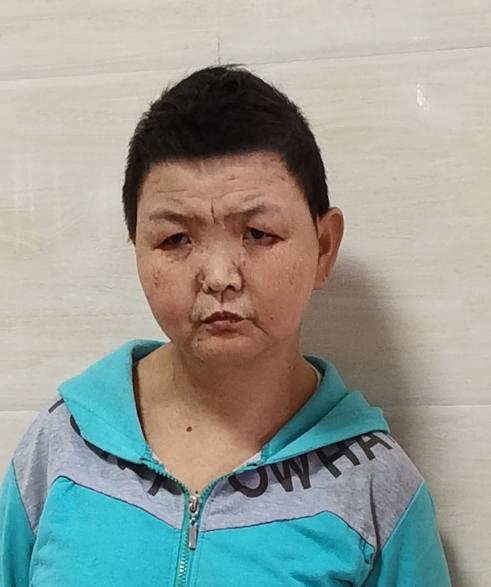 走失者照片 龙岩寻亲：中年女子被救助，微胖，高...
