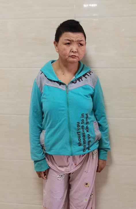 走失者照片 龙岩寻亲：中年女子被救助，微胖，高...