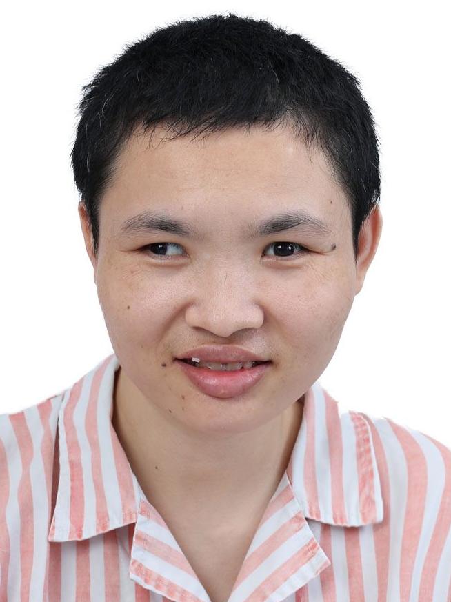 走失者照片 佛山寻亲：青年女子被救助，高1米5...