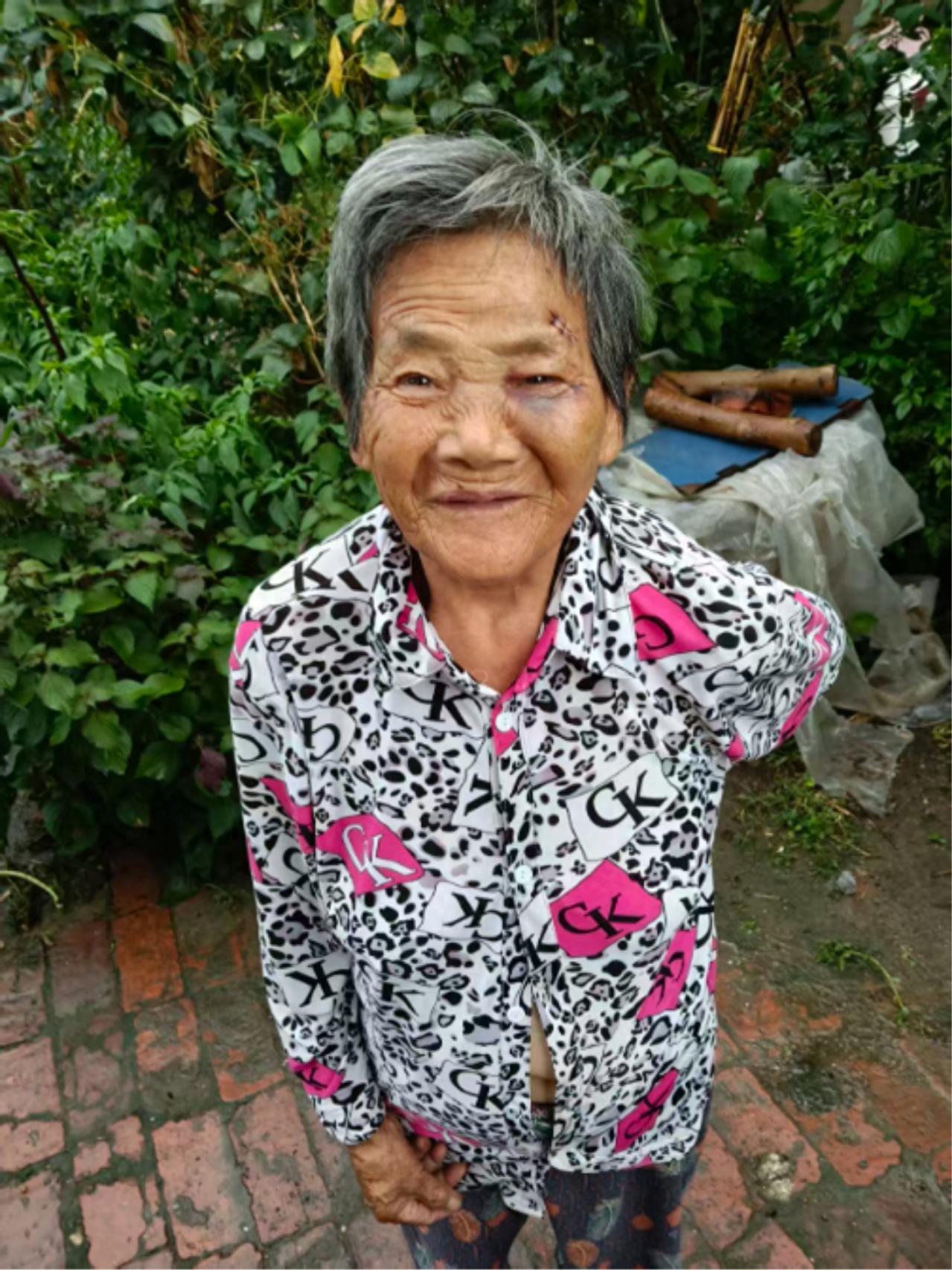 走失者照片 孝感市寻人：七旬老太走失，穿白底黑...