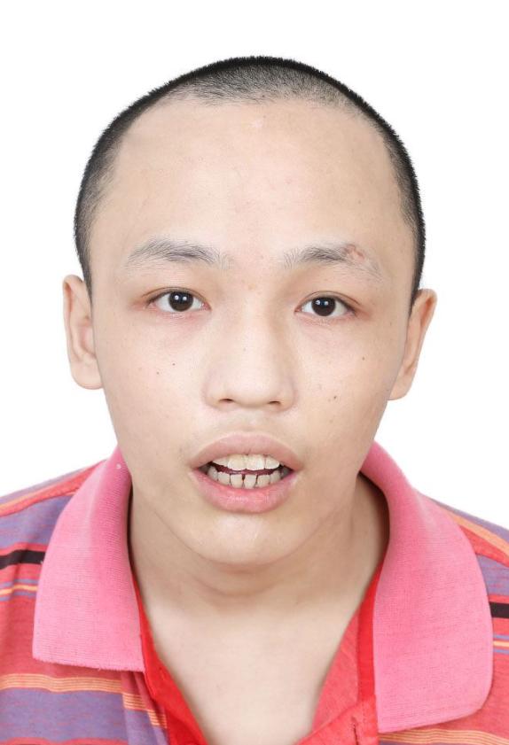 走失者照片 佛山寻亲：17岁男孩被救助，疑似河...