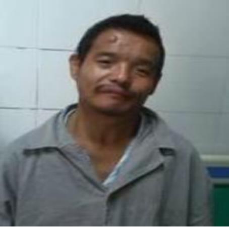 走失者照片 合肥救助站：中年男子被救助，右侧额...
