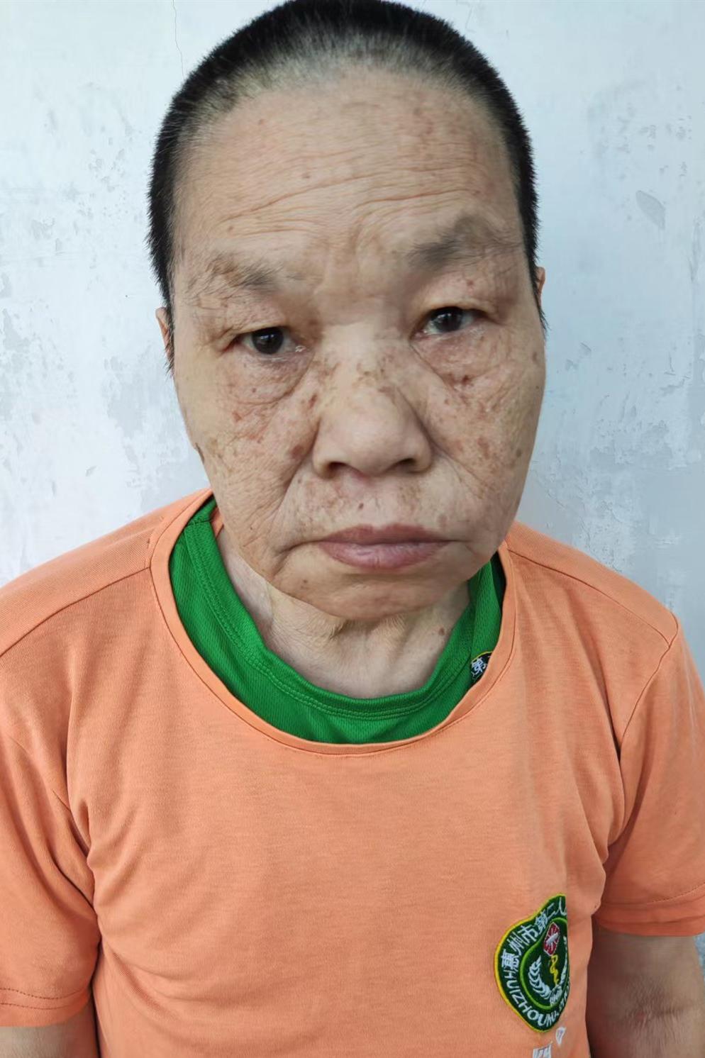 走失者照片 惠州寻亲：六旬老太被救助，高1米5...