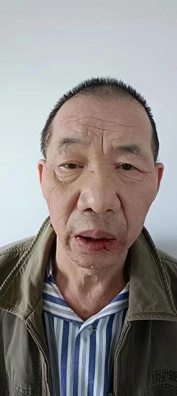走失者照片 许昌长葛市救助站：六旬老人被救助，...