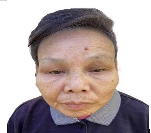 走失者照片 江门台山寻亲：六旬老太被救助，自述...