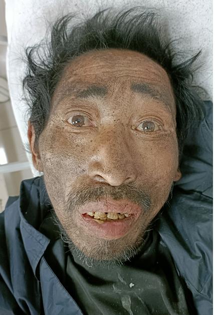 走失者照片 海口寻亲：五旬男子被救治，生前自述...