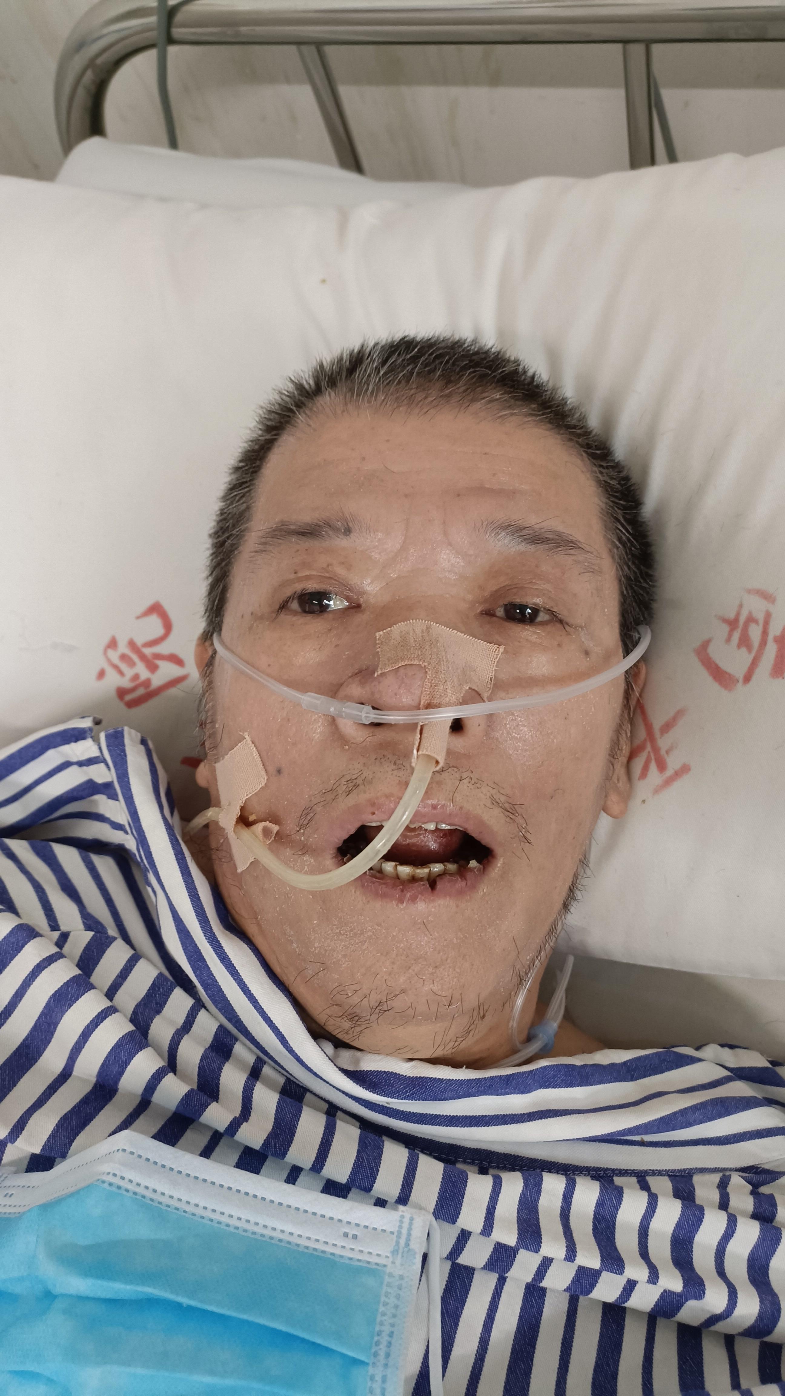 走失者照片 南平寻亲：五旬男子被救助，患脑出血...