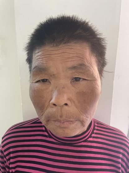 走失者照片 三明寻亲：六旬老太被救助，穿红黑条...