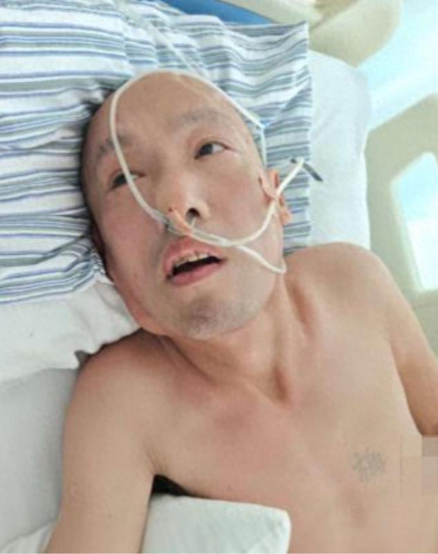 走失者照片 北京市寻亲：五旬男子被救助，胸口处...
