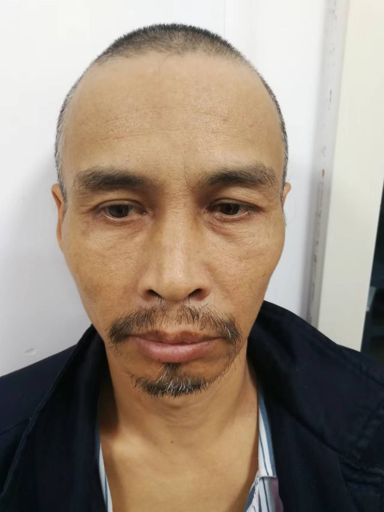 走失者照片 荆州寻亲：中年男子在监利被救助，自...