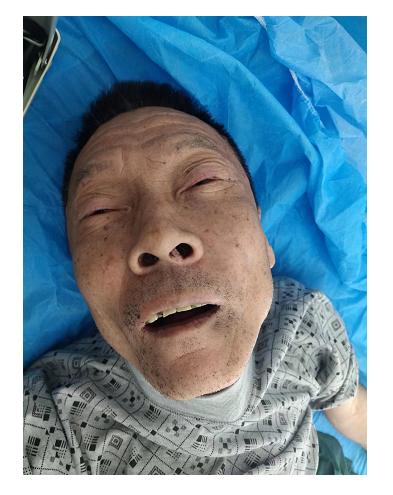 走失者照片 白山急寻：六旬老人被送医，经查叫丛...
