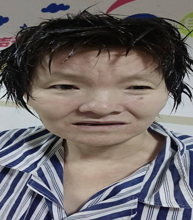 走失者照片 揭阳普宁寻亲：青年女子被救助，穿灰...