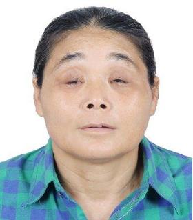 走失者照片 江门寻亲：六旬老太在台山被救助，自...