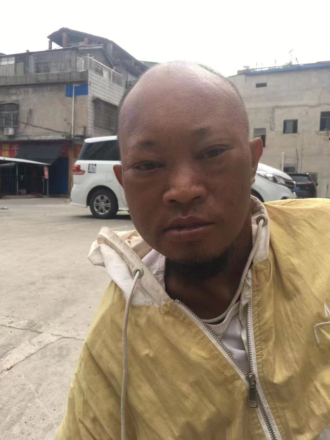 走失者照片 荆州洪湖寻亲：中年男子被救助，自述...