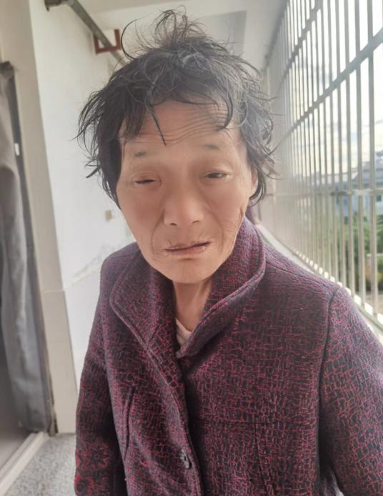 走失者照片 南阳寻亲：六旬老太被救助，眼部残疾...