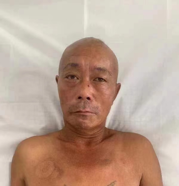 走失者照片 沧州寻亲：六旬老人因车祸被送医，胸...