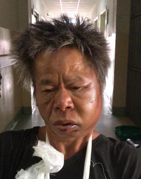 走失者照片 保定寻亲：五旬男子被救助，穿黑色长...