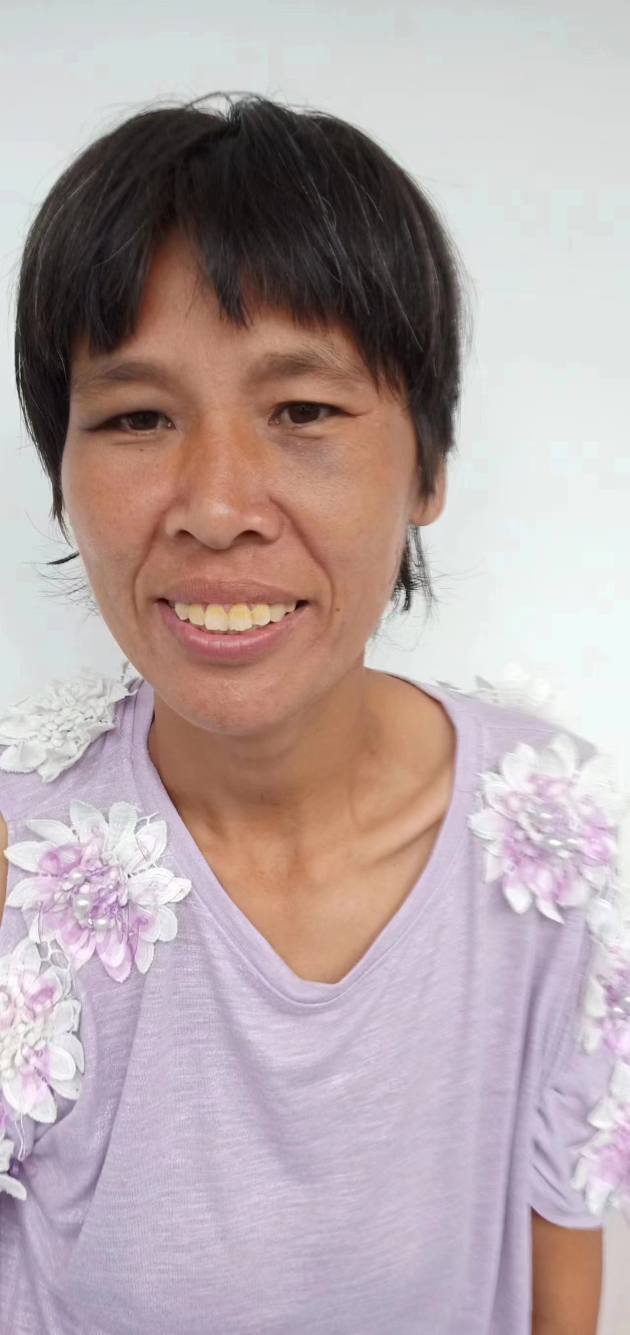 走失者照片 阜阳界首寻亲：中年女子被救助，自述...