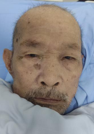 走失者照片 深圳寻亲：八旬老人被送医，自述叫赵...