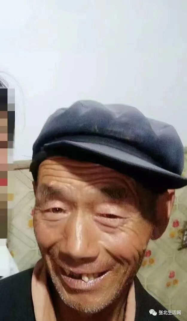 走失者照片 张家口急寻：六旬老人失联，穿蓝色衣...