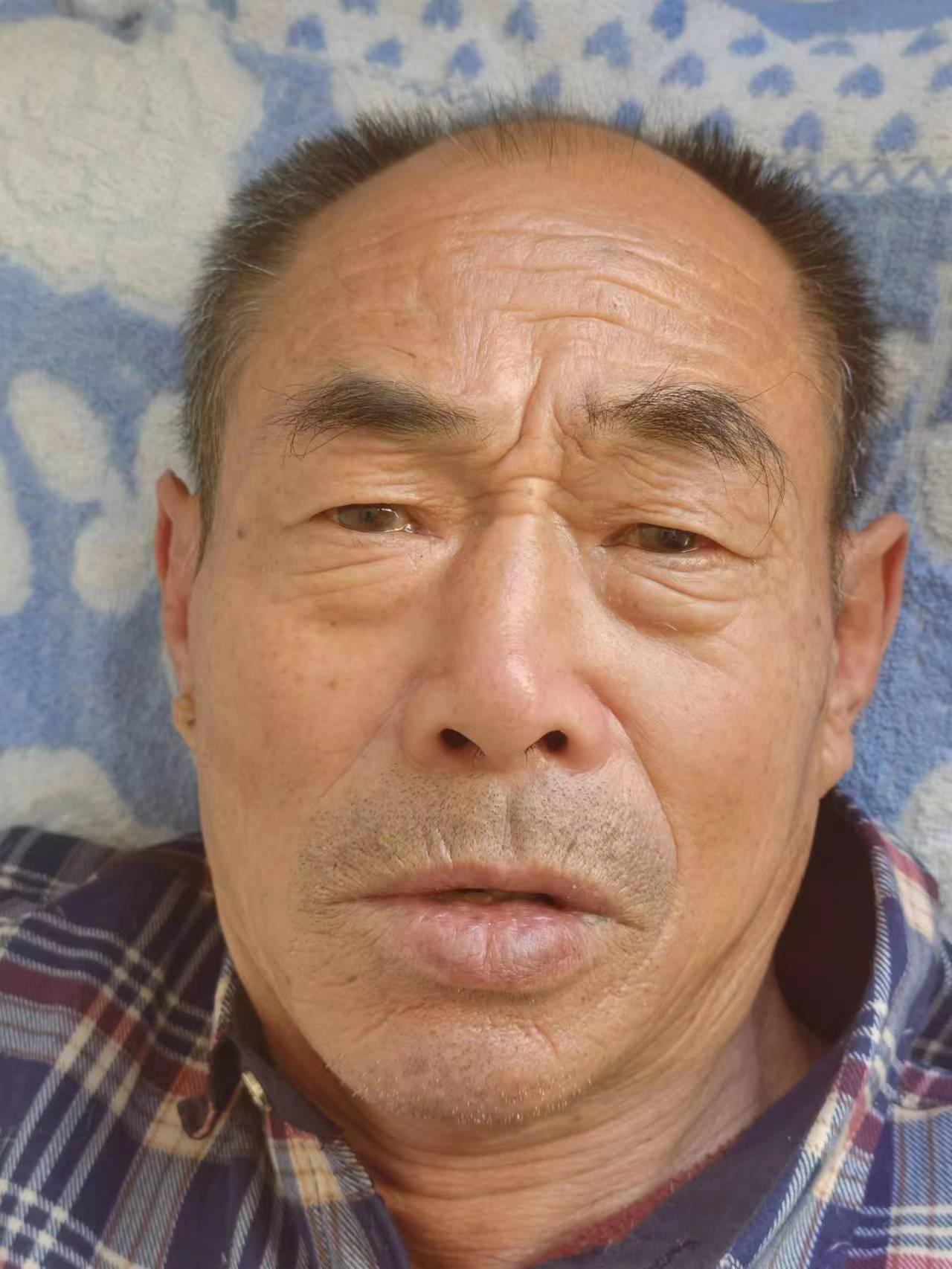 走失者照片 保定寻亲：七旬老人被救助，自述叫张...
