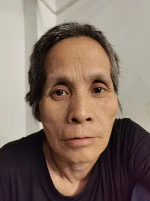 走失者照片 宿州寻亲：六旬老太被救助，腿部残疾...