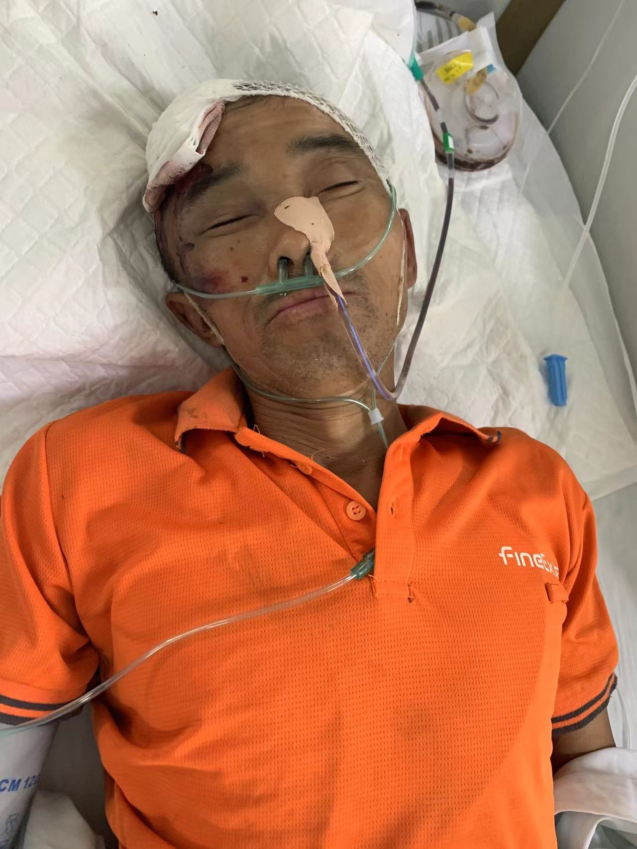走失者照片 郑州寻亲：中年男子被救助，右面部皮...