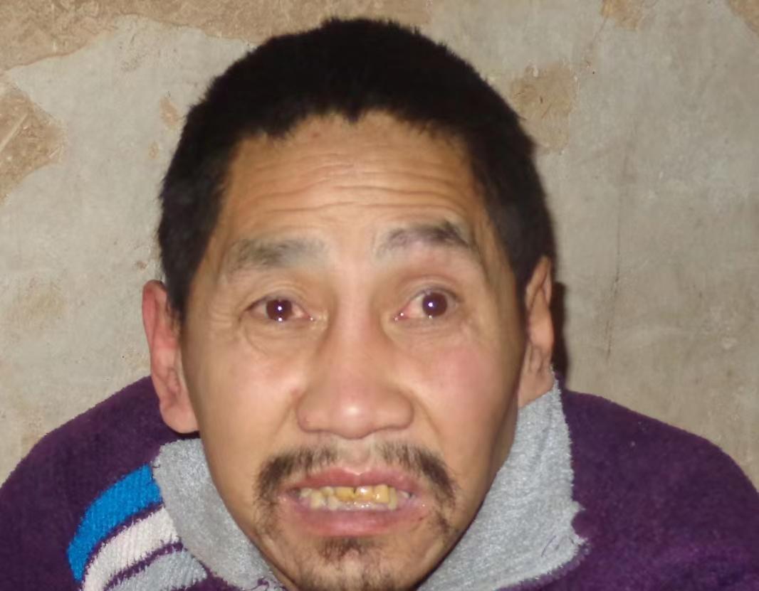 走失者照片 临汾寻亲：五旬男子被救助多年，穿黑...