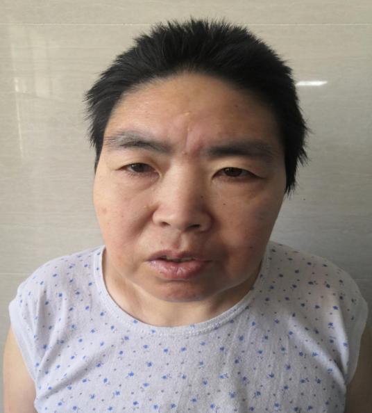 走失者照片 黔东南州寻亲：中年女子被救助，高1...