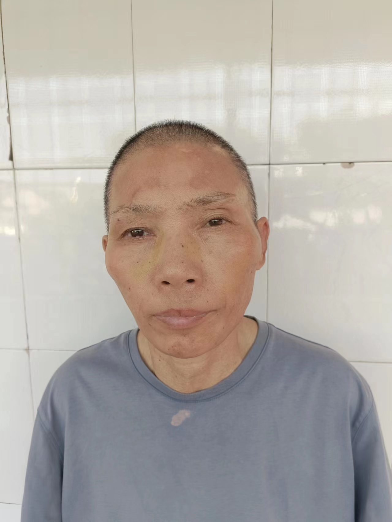 走失者照片 岳阳寻亲：六旬老太被救助，自述叫陈...