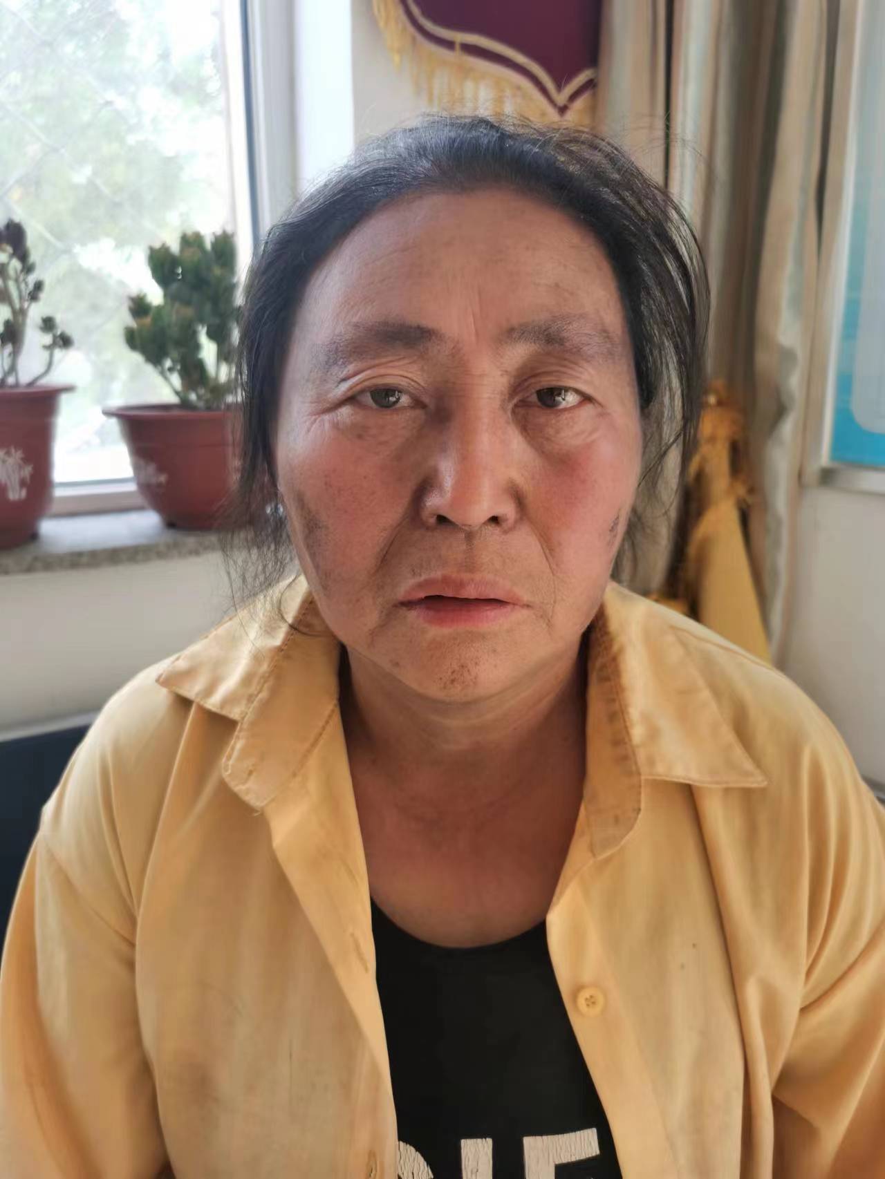 走失者照片 朔州怀仁寻亲：五旬女子被救助，穿黑...