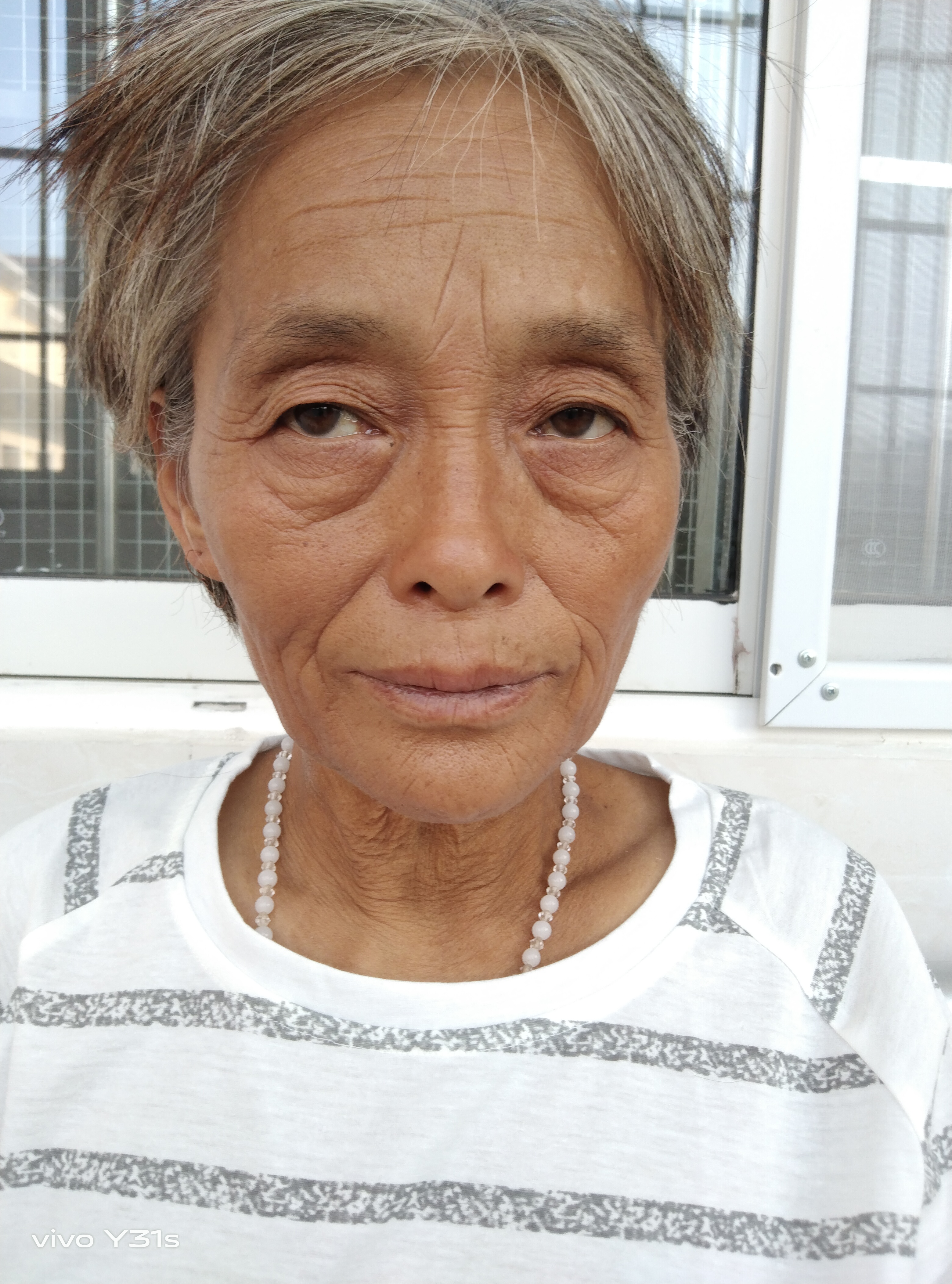 走失者照片 亳州寻亲：五旬女子被救助，花白短发...