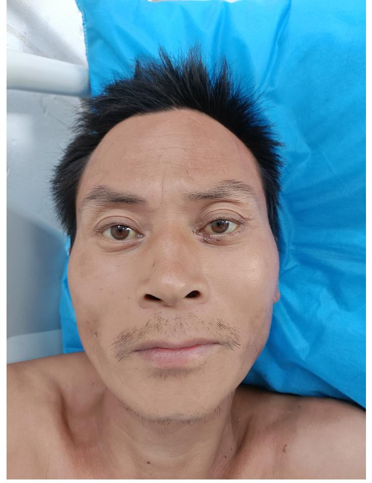 走失者照片 海口寻亲：中年男子被送医，疑似叫吴...