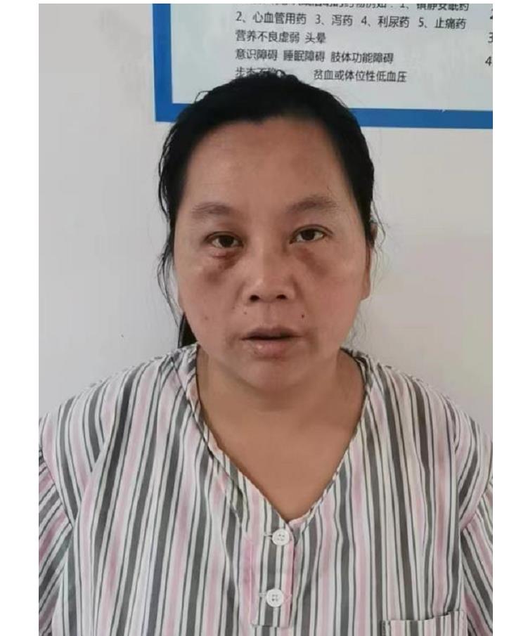 走失者照片 合肥寻亲：五旬女子被救助多年，高1...