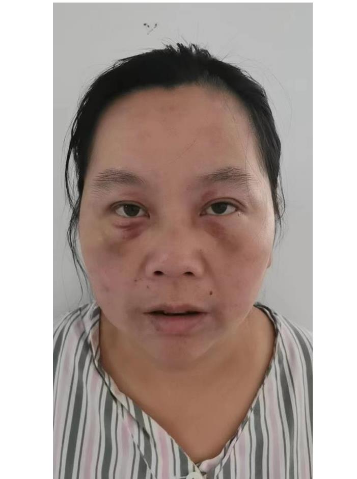 走失者照片 合肥寻亲：五旬女子被救助多年，高1...