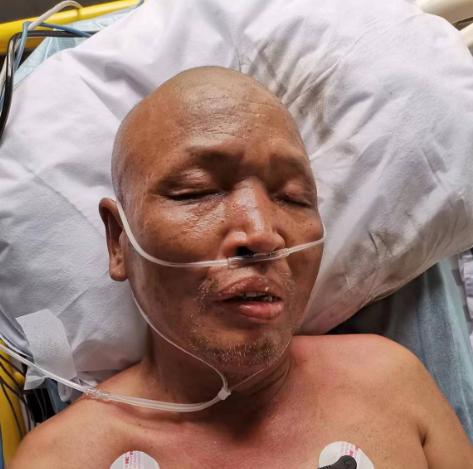 走失者照片 佛山寻亲：六旬老人被送医，光头，名...