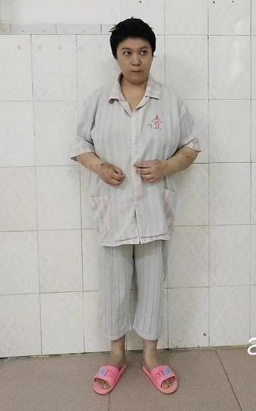 走失者照片 百色寻亲：中年女子被救助，高1米5...