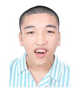 走失者照片 郑州寻亲：中年男子在佛山被救助多年...