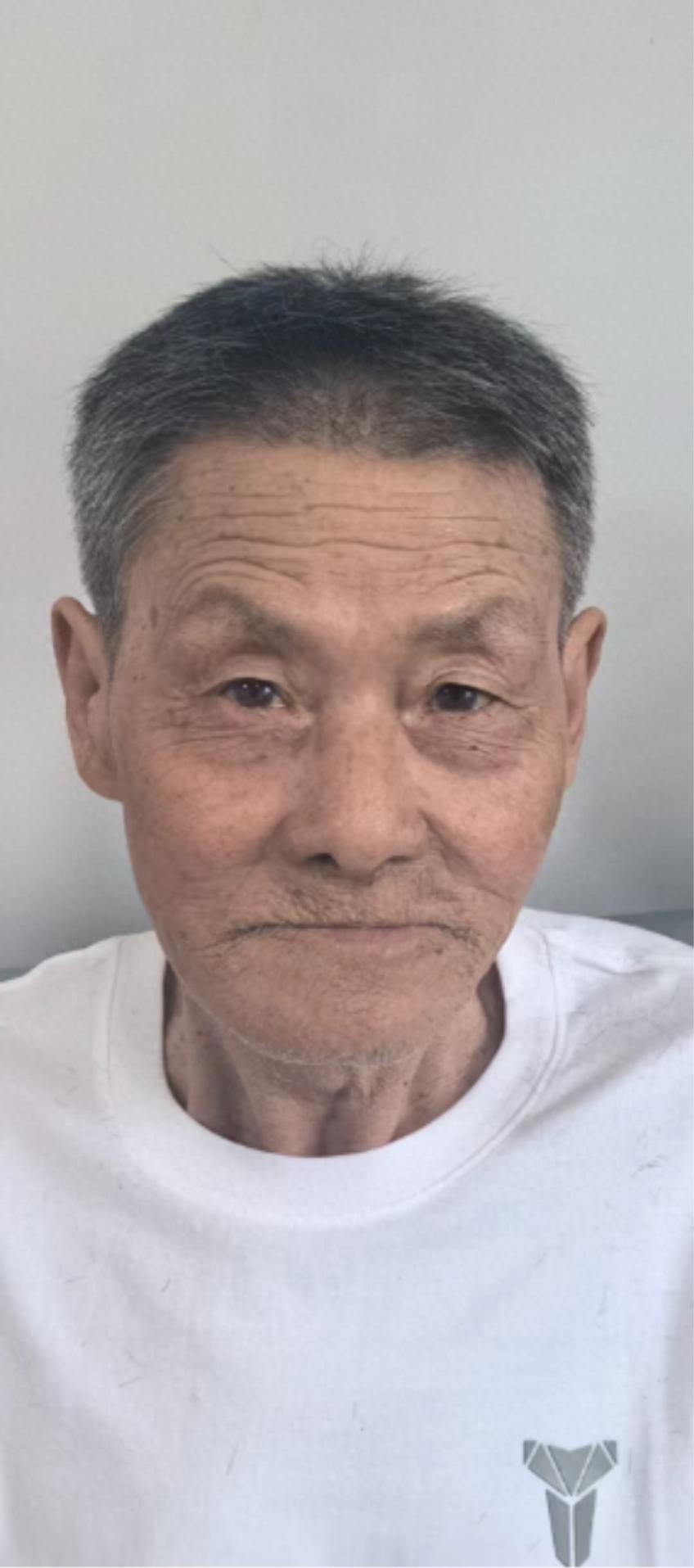 走失者照片 沧州市寻亲：七旬老人被救助，高约1...
