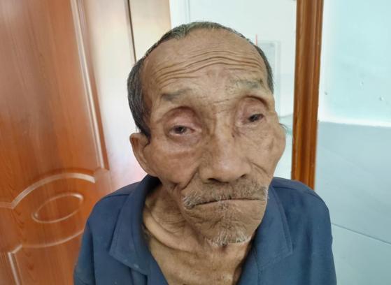 走失者照片 泸州寻亲：八旬老人被救助，穿天蓝色...