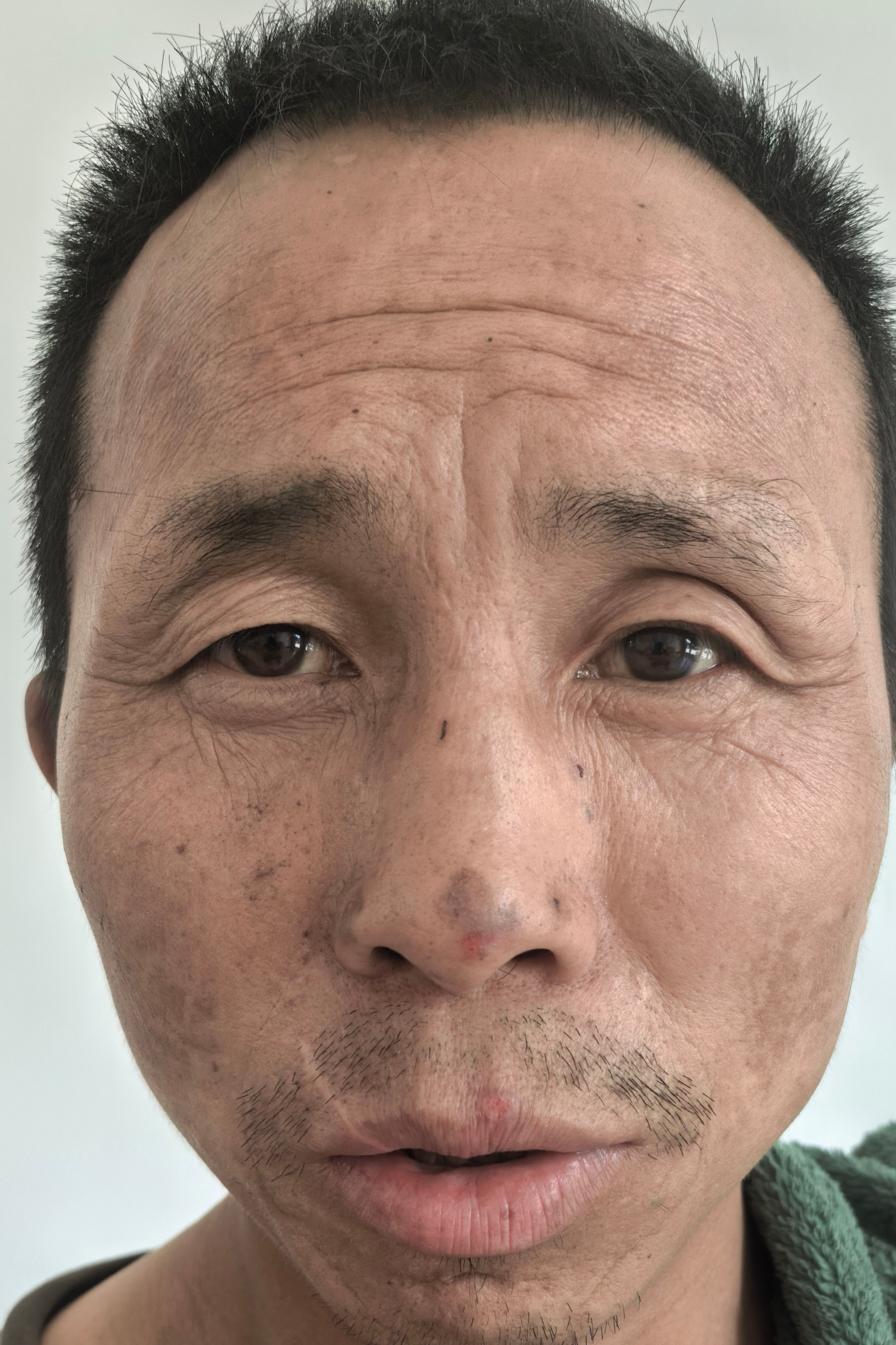 走失者照片 全国救助站