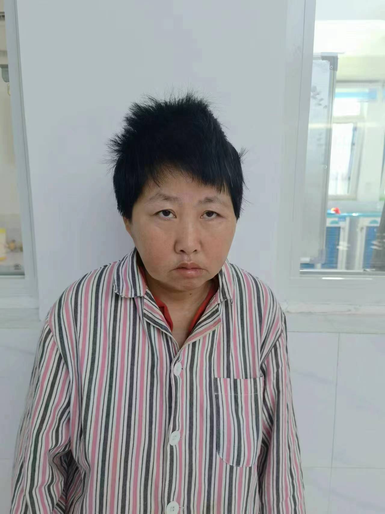 走失者照片 东营寻亲：中年女子被救助，疑似精神...