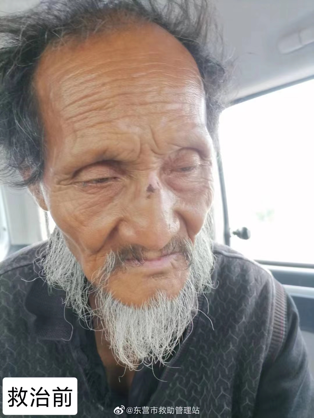 走失者照片 东营寻亲：七旬老人被救助，右手畸形...