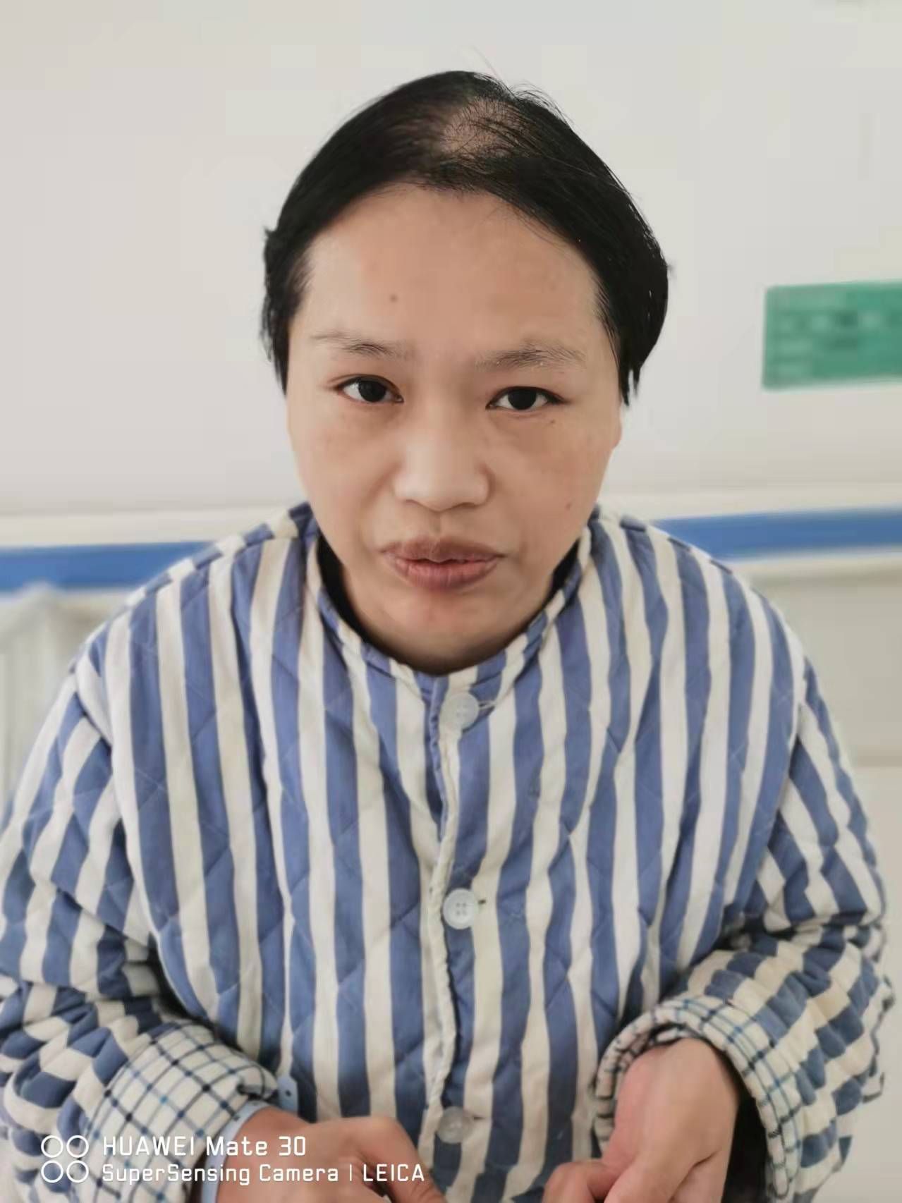 走失者照片 菏泽寻亲：中年女子被救助，高约1米...