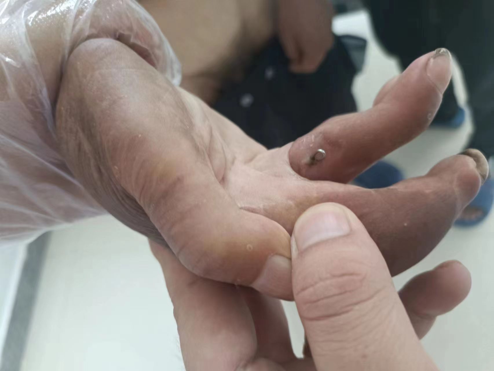 走失者照片 东营寻亲：七旬老人被救助，右手畸形...