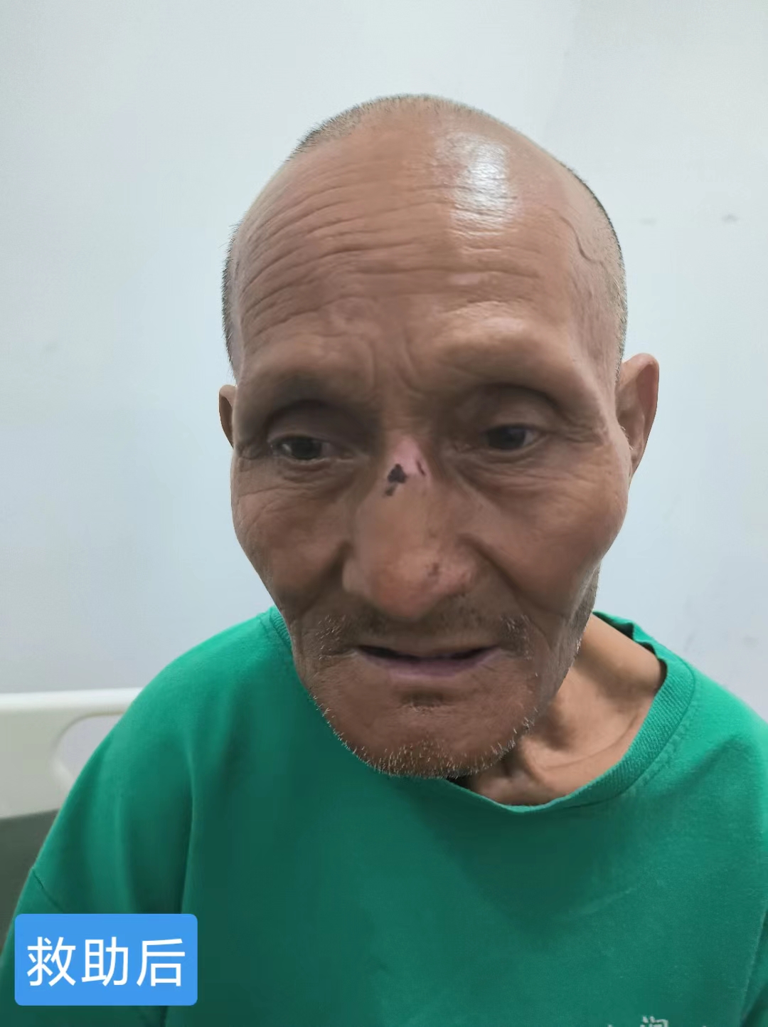 走失者照片 东营寻亲：七旬老人被救助，右手畸形...