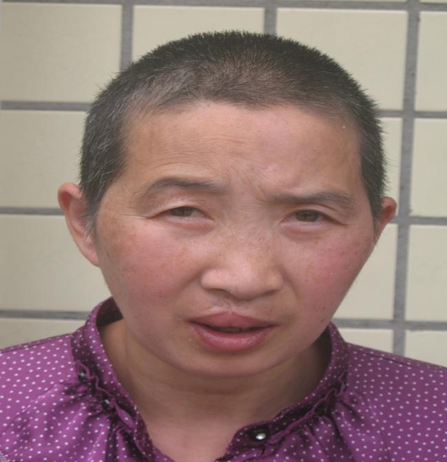 走失者照片 成都寻亲：中年女子被救助，智力异常...