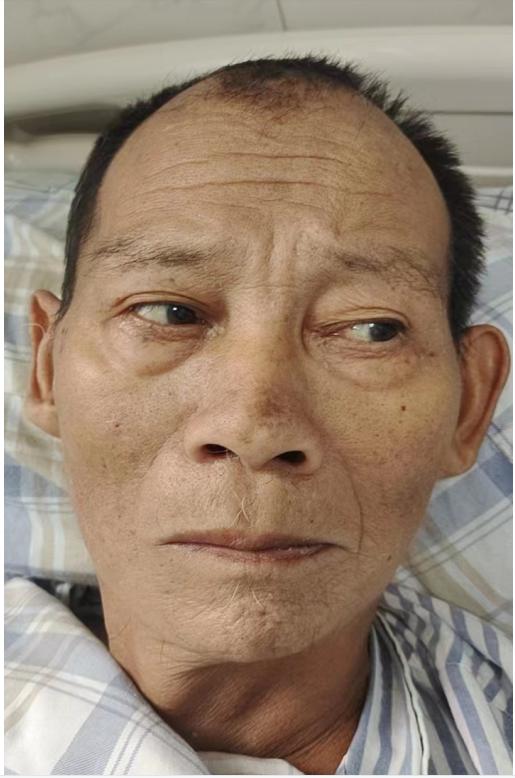 走失者照片 广州寻亲：六旬老人被救助，高1米7...