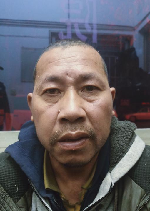 走失者照片 衢州寻亲：江山五旬男子被救助，鼻梁...